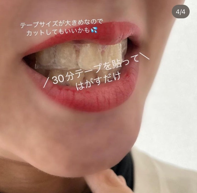 クレスト ホワイトストリップ プロフェッショナルエフェクト ホワイトニング テープ 5回分 Crest 3d White Professional Effect White Strip